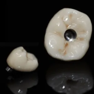 Fabricación en laboratorio dental digital de coronas cerámicas, emax y zirconio